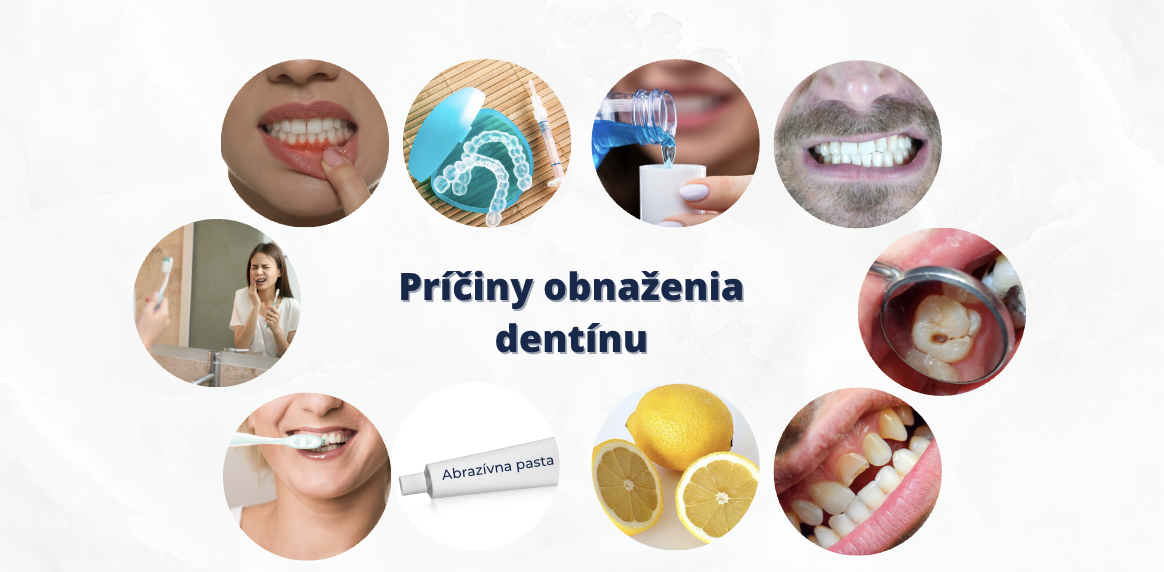 Príčiny obnaženia dentínu